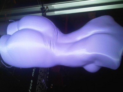 look women get cellulite even in plastic