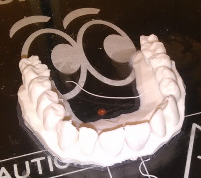 upperteeth.jpg